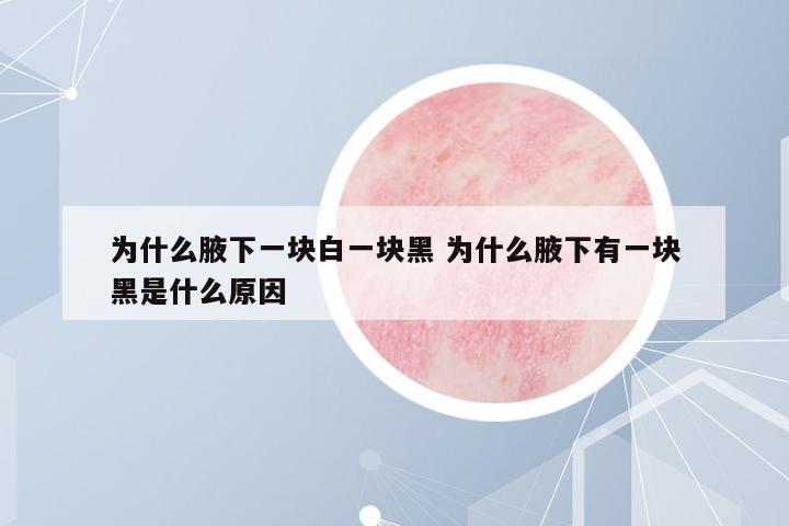 為什么腋下一塊白一塊黑 為什么腋下有一塊黑是什么原因