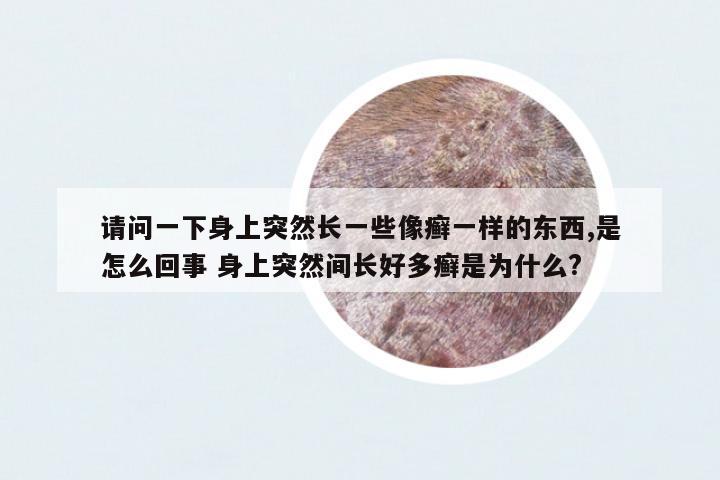 請問一下身上突然長一些像癬一樣的東西,是怎么回事 身上突然間長好多癬是為什么?