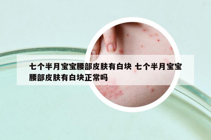 七個(gè)半月寶寶腰部皮膚有白塊 七個(gè)半月寶寶腰部皮膚有白塊正常嗎