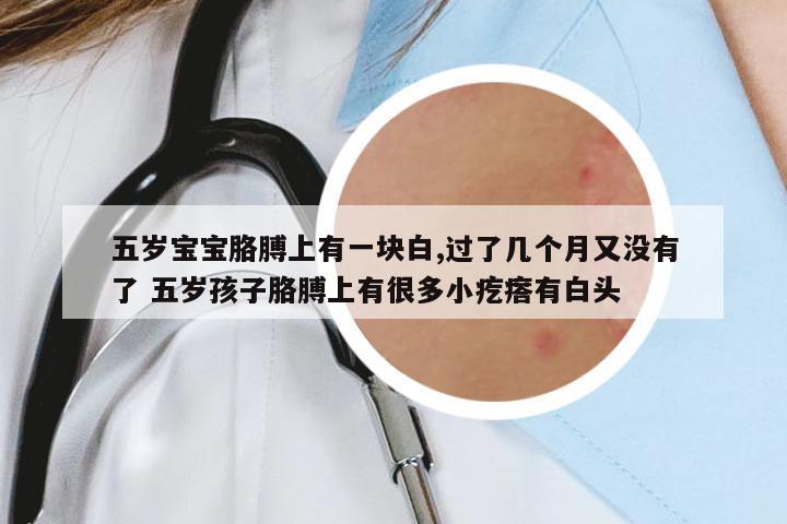 五歲寶寶胳膊上有一塊白,過了幾個(gè)月又沒有了 五歲孩子胳膊上有很多小疙瘩有白頭