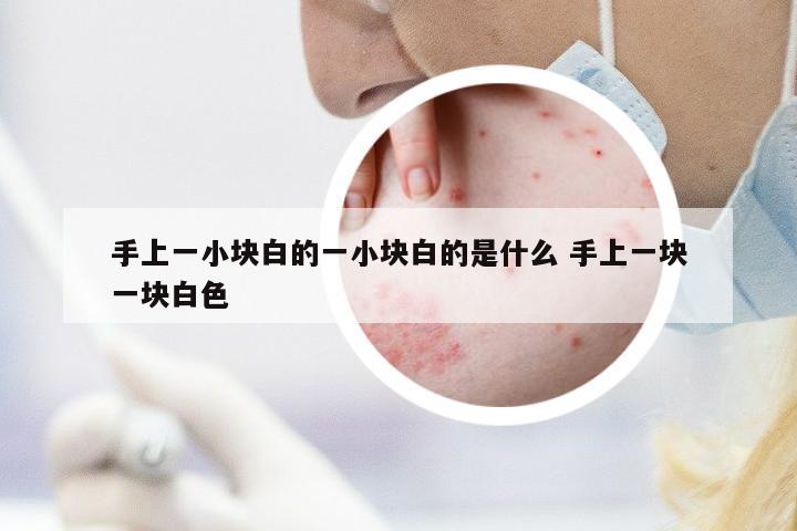 手上一小塊白的一小塊白的是什么 手上一塊一塊白色