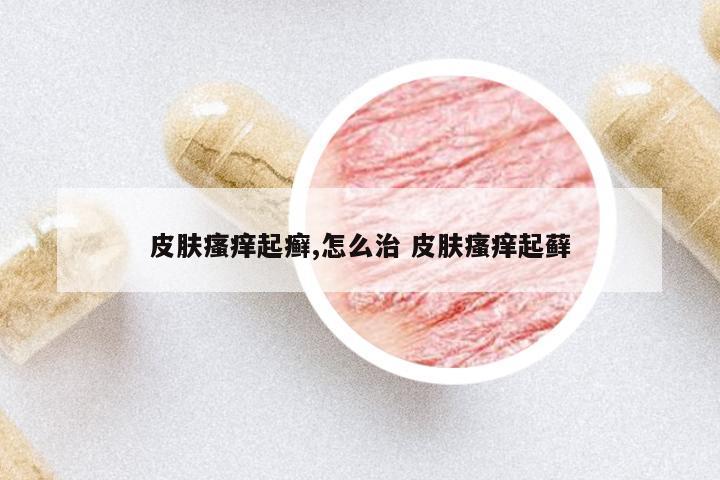 皮膚瘙癢起癬,怎么治 皮膚瘙癢起蘚