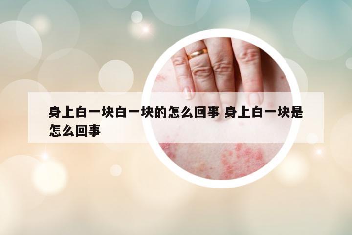身上白一塊白一塊的怎么回事 身上白一塊是怎么回事