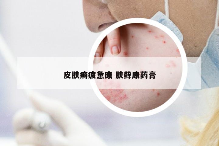 皮膚癬疲憊康 膚蘚康藥膏