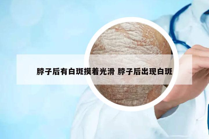 脖子后有白斑摸著光滑 脖子后出現(xiàn)白斑