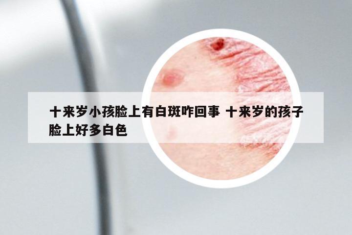 十來歲小孩臉上有白斑咋回事 十來歲的孩子臉上好多白色