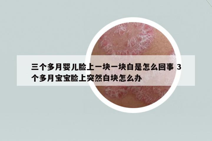 三個多月嬰兒臉上一塊一塊白是怎么回事 3個多月寶寶臉上突然白塊怎么辦