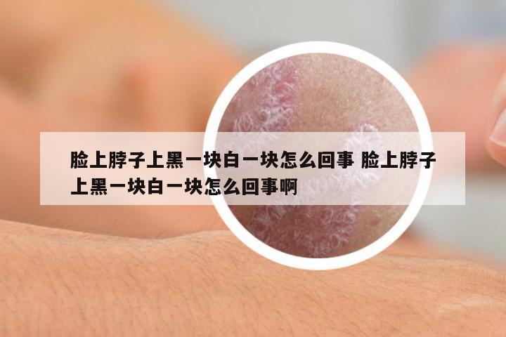 臉上脖子上黑一塊白一塊怎么回事 臉上脖子上黑一塊白一塊怎么回事啊