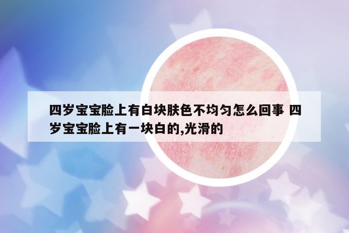 四歲寶寶臉上有白塊膚色不均勻怎么回事 四歲寶寶臉上有一塊白的,光滑的