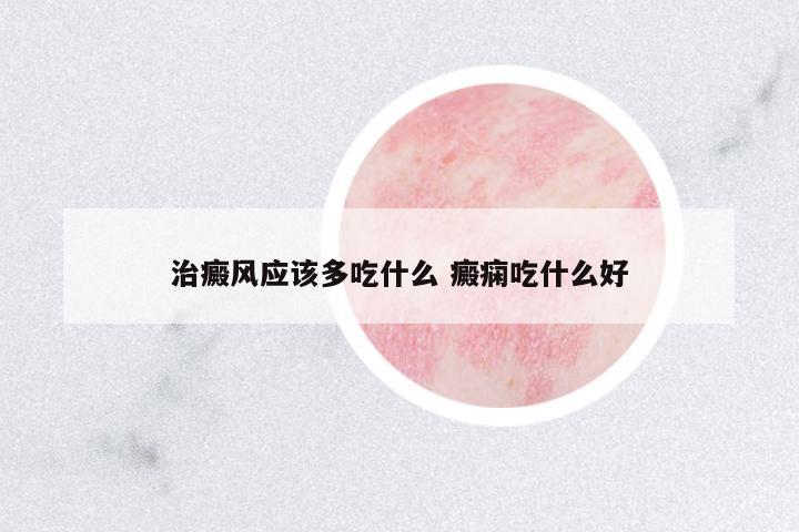 治癜風(fēng)應(yīng)該多吃什么 癜癇吃什么好