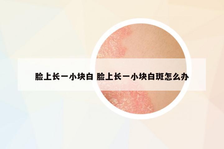 臉上長一小塊白 臉上長一小塊白斑怎么辦