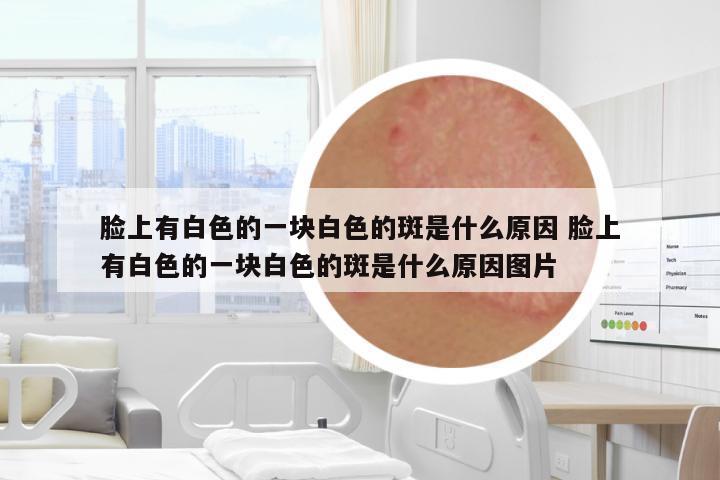 臉上有白色的一塊白色的斑是什么原因 臉上有白色的一塊白色的斑是什么原因圖片