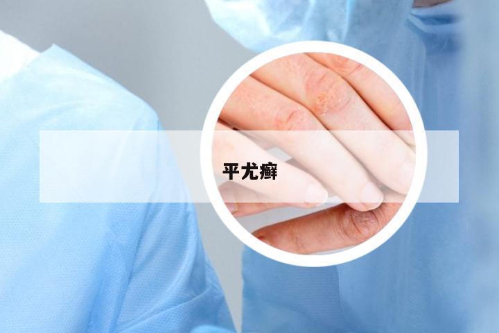 平尤癬