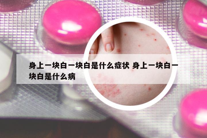 身上一塊白一塊白是什么癥狀 身上一塊白一塊白是什么病