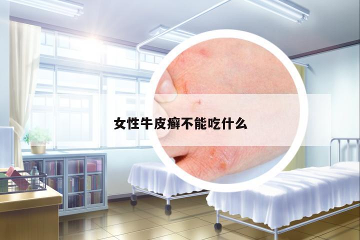 女性牛皮癬不能吃什么