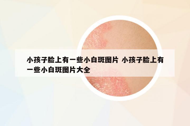 小孩子臉上有一些小白斑圖片 小孩子臉上有一些小白斑圖片大全