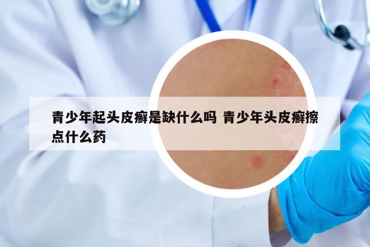 青少年起頭皮癬是缺什么嗎 青少年頭皮癬擦點什么藥