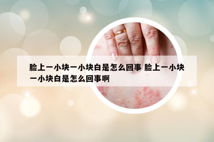 臉上一小塊一小塊白是怎么回事 臉上一小塊一小塊白是怎么回事啊