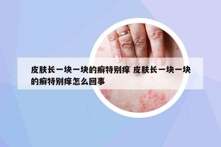 皮膚長一塊一塊的癬特別癢 皮膚長一塊一塊的癬特別癢怎么回事