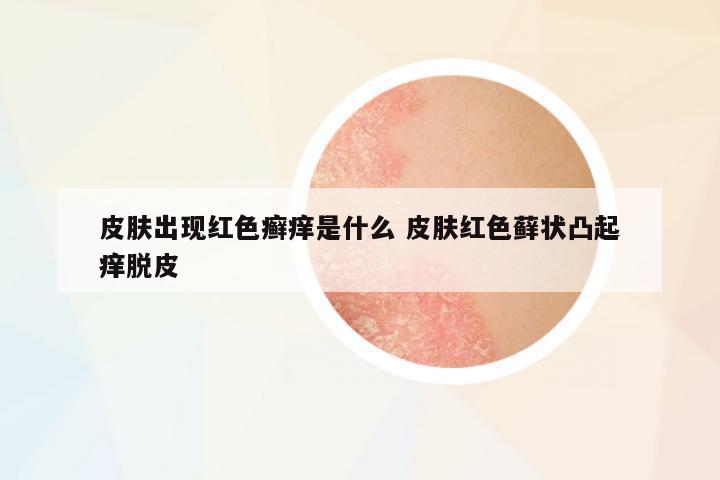 皮膚出現(xiàn)紅色癬癢是什么 皮膚紅色蘚狀凸起癢脫皮