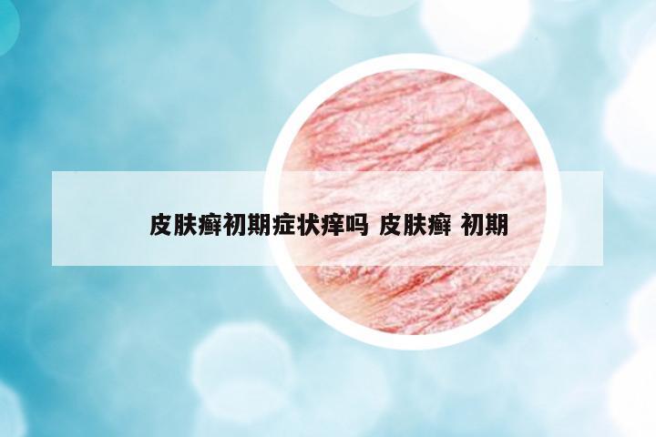 皮膚癬初期癥狀癢嗎 皮膚癬 初期