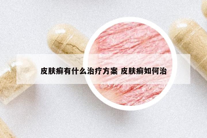 皮膚癬有什么治療方案 皮膚癬如何治