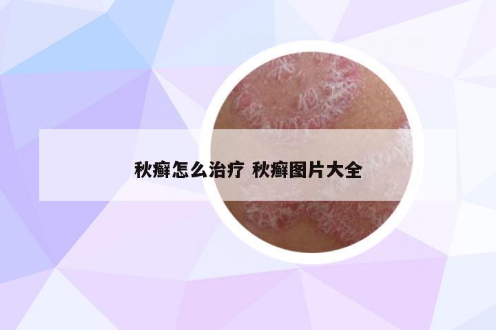 秋癬怎么治療 秋癬圖片大全