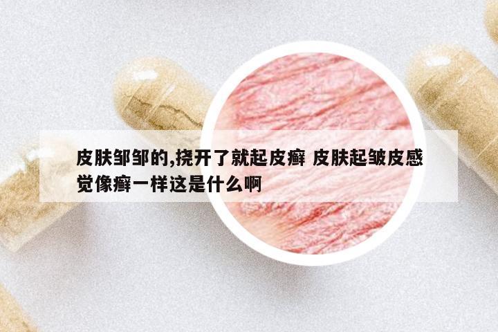 皮膚鄒鄒的,撓開了就起皮癬 皮膚起皺皮感覺像癬一樣這是什么啊