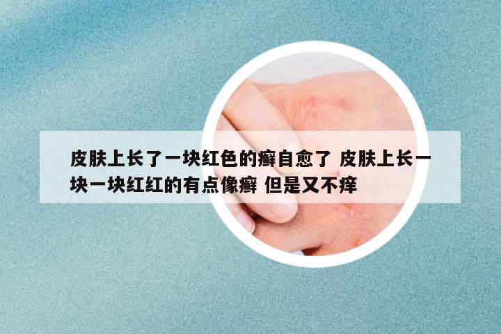 皮膚上長(zhǎng)了一塊紅色的癬自愈了 皮膚上長(zhǎng)一塊一塊紅紅的有點(diǎn)像癬 但是又不癢