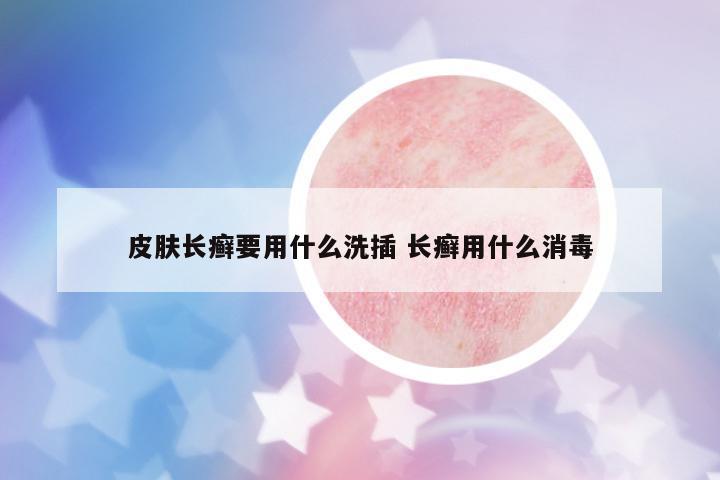 皮膚長癬要用什么洗插 長癬用什么消毒