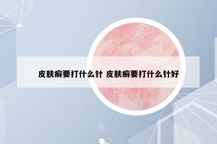 皮膚癬要打什么針 皮膚癬要打什么針好