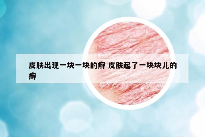 皮膚出現(xiàn)一塊一塊的癬 皮膚起了一塊塊兒的癬