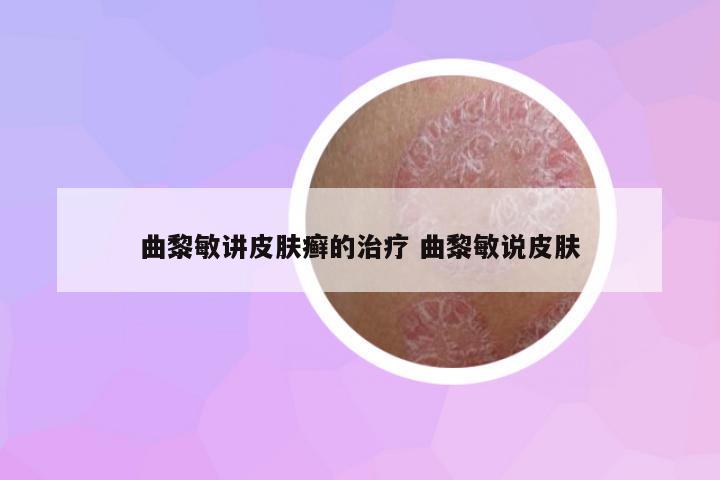曲黎敏講皮膚癬的治療 曲黎敏說皮膚