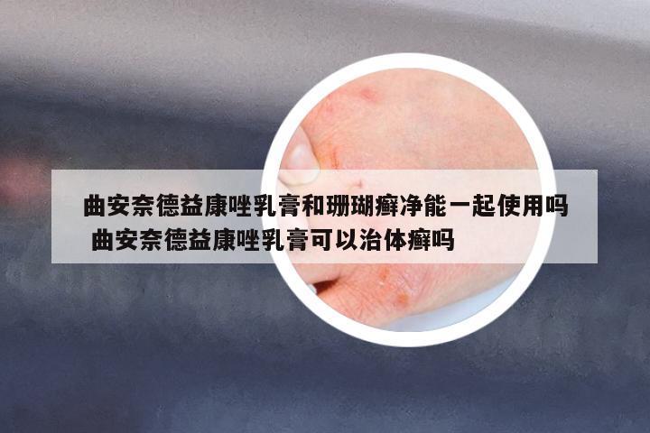 曲安奈德益康唑乳膏和珊瑚癬凈能一起使用嗎 曲安奈德益康唑乳膏可以治體癬嗎