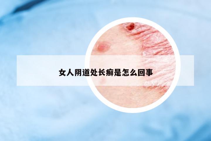 女人陰道處長(zhǎng)癬是怎么回事