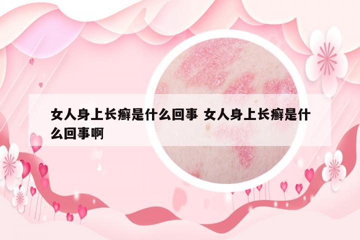 女人身上長癬是什么回事 女人身上長癬是什么回事啊