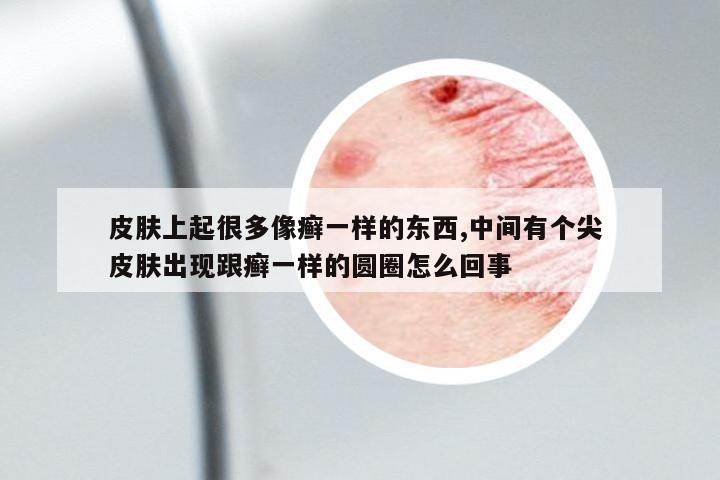 皮膚上起很多像癬一樣的東西,中間有個尖 皮膚出現(xiàn)跟癬一樣的圓圈怎么回事