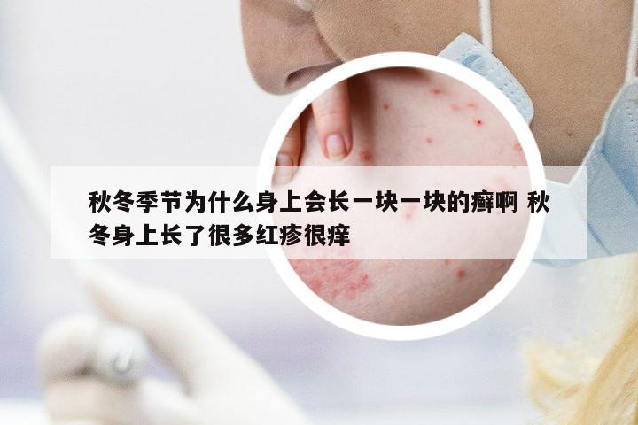 秋冬季節(jié)為什么身上會長一塊一塊的癬啊 秋冬身上長了很多紅疹很癢