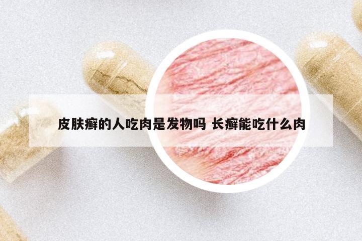 皮膚癬的人吃肉是發(fā)物嗎 長癬能吃什么肉