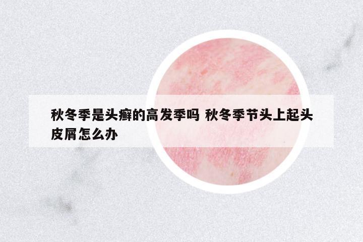 秋冬季是頭癬的高發(fā)季嗎 秋冬季節(jié)頭上起頭皮屑怎么辦