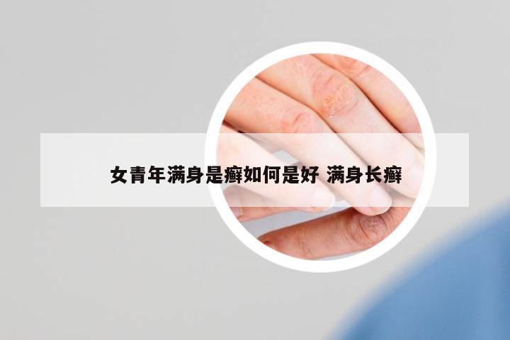女青年滿身是癬如何是好 滿身長(zhǎng)癬