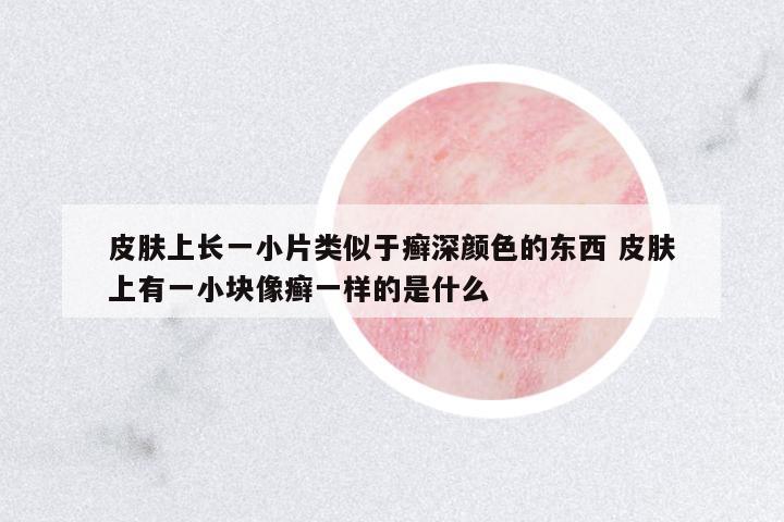 皮膚上長一小片類似于癬深顏色的東西 皮膚上有一小塊像癬一樣的是什么