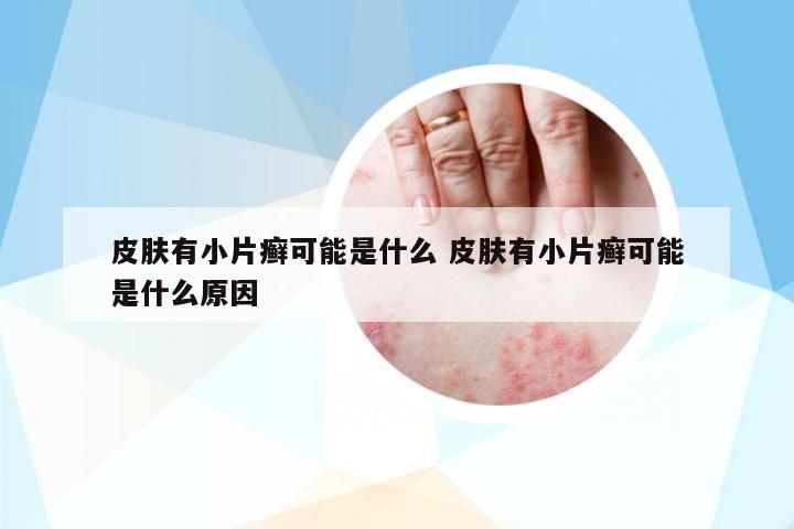 皮膚有小片癬可能是什么 皮膚有小片癬可能是什么原因