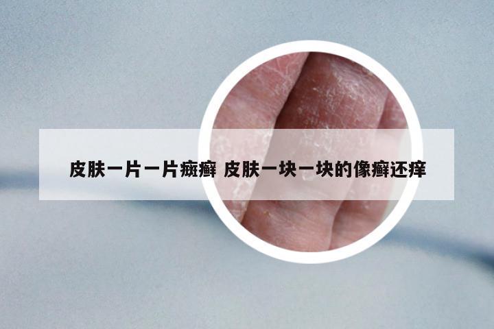 皮膚一片一片癍癬 皮膚一塊一塊的像癬還癢