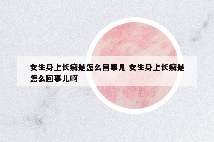 女生身上長癬是怎么回事兒 女生身上長癬是怎么回事兒啊