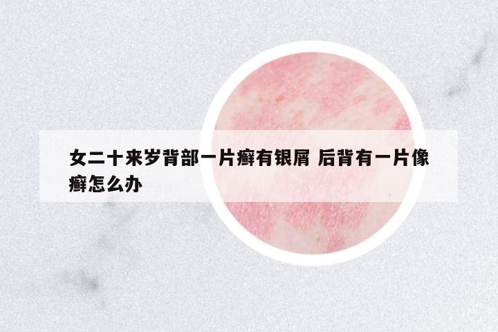 女二十來歲背部一片癬有銀屑 后背有一片像癬怎么辦
