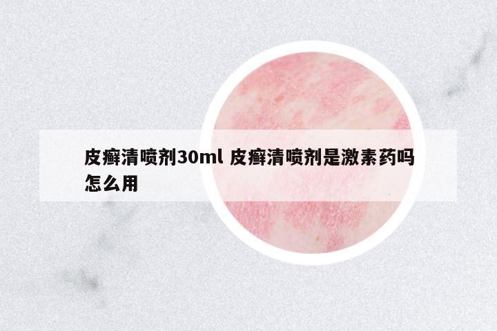 皮癬清噴劑30ml 皮癬清噴劑是激素藥嗎怎么用