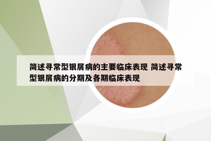 簡述尋常型銀屑病的主要臨床表現(xiàn) 簡述尋常型銀屑病的分期及各期臨床表現(xiàn)