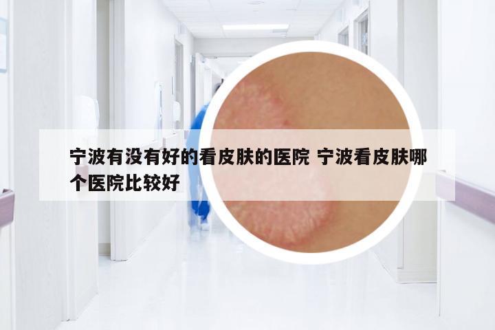 寧波有沒有好的看皮膚的醫(yī)院 寧波看皮膚哪個醫(yī)院比較好