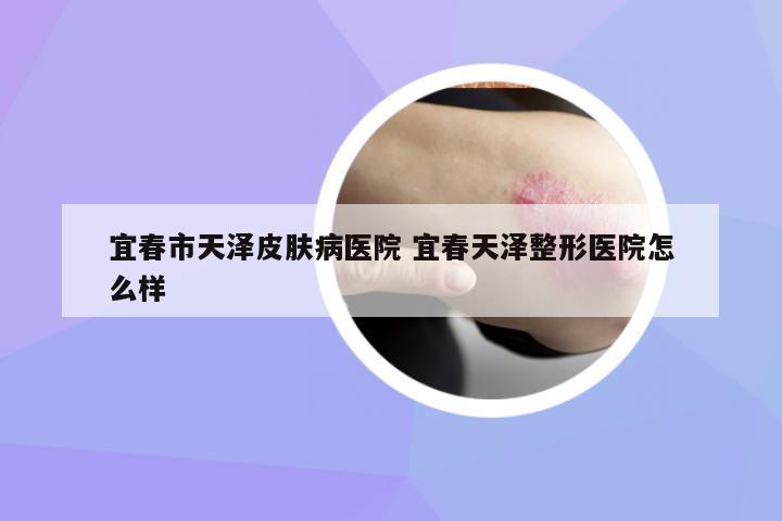 宜春市天澤皮膚病醫(yī)院 宜春天澤整形醫(yī)院怎么樣